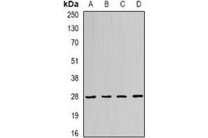 Image no. 2 for anti-RAB11A, Member RAS Oncogene Family (RAB11A) antibody (ABIN2966968)