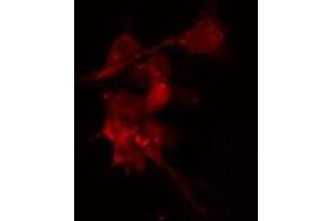 Image no. 2 for anti-Protein Kinase, CAMP Dependent, Catalytic, beta (PRKACB) antibody (ABIN6257011)