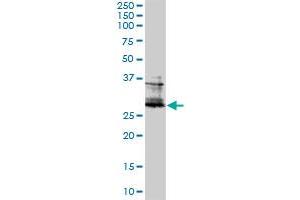 Image no. 1 for anti-FOS-Like Antigen 2 (FOSL2) (AA 1-122) antibody (ABIN560942)