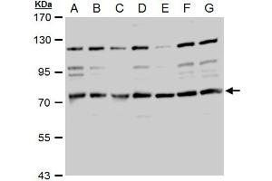 Image no. 2 for anti-Transforming, Acidic Coiled-Coil Containing Protein 2 (TACC2) (N-Term) antibody (ABIN2856762)