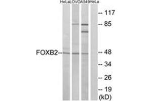 Image no. 1 for anti-Forkhead Box B2 (FOXB2) (AA 251-300) antibody (ABIN1534908)