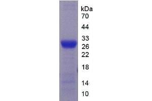 Image no. 4 for Cytochrome P450, Family 2, Subfamily E, Polypeptide 1 (CYP2E1) ELISA Kit (ABIN6720507)