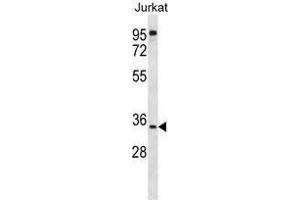 Image no. 1 for anti-UBX Domain Protein 8 (UBXN8) (AA 58-87), (N-Term) antibody (ABIN955438)