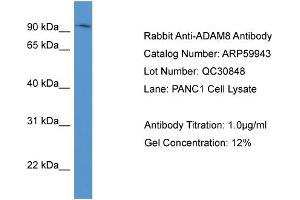 Image no. 2 for anti-ADAM Metallopeptidase Domain 8 (ADAM8) (N-Term) antibody (ABIN2788269)