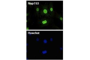Image no. 3 for anti-Nucleoporin 153kDa (NUP153) (AA 610-1191) antibody (ABIN2452062)
