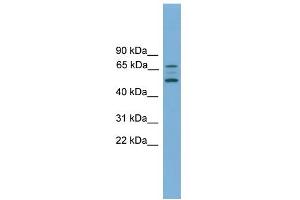 Image no. 1 for anti-Activin A Receptor, Type IIB (ACVR2B) (Middle Region) antibody (ABIN2782111)