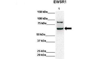 Image no. 2 for anti-Ewing Sarcoma Breakpoint Region 1 (EWSR1) (Middle Region) antibody (ABIN2779045)