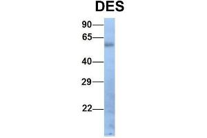Image no. 3 for anti-Desmin (DES) (Middle Region) antibody (ABIN2776843)