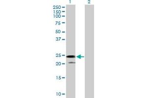 Western Blot analysis of IL24 expression in transfected 293T cell line by IL24 MaxPab polyclonal antibody.