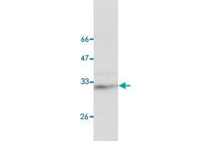 Image no. 1 for anti-Stomatin (STOM) antibody (ABIN5588920)