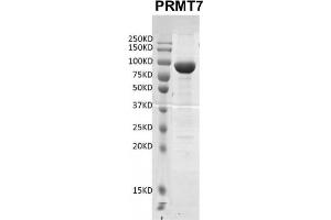 Image no. 1 for Protein Arginine Methyltransferase 7 (PRMT7) protein (DYKDDDDK Tag) (ABIN2669660)