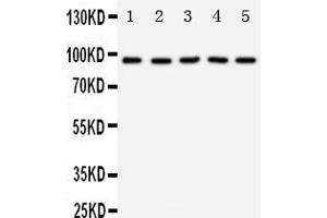 Image no. 1 for anti-Neurotrophic tyrosine Kinase, Receptor, Type 3 (NTRK3) (AA 167-182), (N-Term) antibody (ABIN5518697)