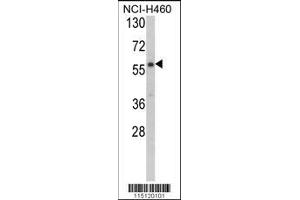 anti-Cysteinyl-tRNA Synthetase 2, Mitochondrial (Putative) (CARS2) (AA 536-564), (C-Term) antibody