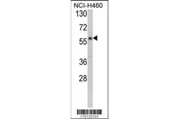 anti-Cysteinyl-tRNA Synthetase 2, Mitochondrial (Putative) (CARS2) (AA 536-564), (C-Term) antibody