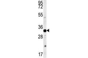 Image no. 3 for anti-Aquaporin 11 (AQP11) (AA 244-271) antibody (ABIN3028471)