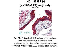Image no. 1 for anti-Matrix Metallopeptidase 14 (Membrane-inserted) (MMP14) (AA 160-173) antibody (ABIN2852383)