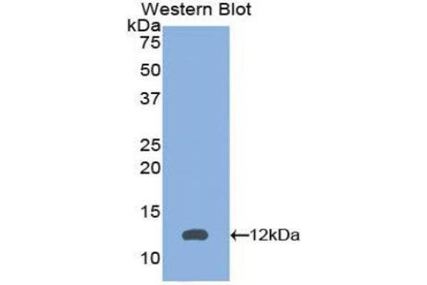 anti-Peroxisomal Biogenesis Factor 2 (PEX2) (AA 28-118) antibody