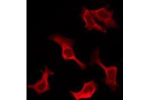 Image no. 3 for anti-Interleukin 10 Receptor, alpha (IL10RA) (C-Term) antibody (ABIN6262532)