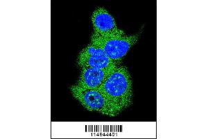 Image no. 1 for anti-Aldolase (ALD) (AA 66-95), (N-Term) antibody (ABIN5530350)