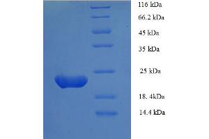 Image no. 1 for Zinc Finger Protein GLI1 (GLI1) (AA 921-1106), (partial) protein (His tag) (ABIN5712830)