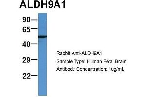 Image no. 4 for anti-Aldehyde Dehydrogenase 9 Family, Member A1 (ALDH9A1) (C-Term) antibody (ABIN2788130)