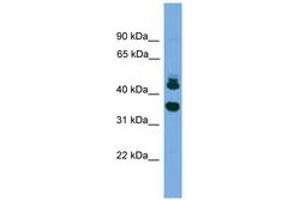 Image no. 1 for anti-Sorting Nexin 32 (SNX32) (AA 251-300) antibody (ABIN6745574)