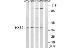 Image no. 1 for anti-Homeobox B2 (HOXB2) (AA 41-90) antibody (ABIN1534983)