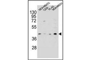 Image no. 3 for anti-HERV-H LTR-Associating 2 (HHLA2) (AA 65-95), (N-Term) antibody (ABIN952731)