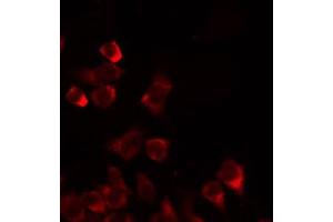 Image no. 2 for anti-Mitochondrial Ribosomal Protein L35 (MRPL35) (Internal Region) antibody (ABIN6259594)