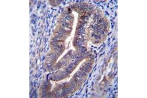 Image no. 1 for anti-Endosome/Lysosome-associated Apoptosis and Autophagy Regulator 1 (ELAPOR1) (AA 703-732), (C-Term) antibody (ABIN953056)