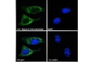 Image no. 3 for anti-Biglycan (BGN) (C-Term) antibody (ABIN334359)