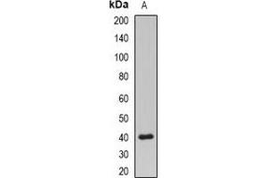 Image no. 2 for anti-Protein Phosphatase 2A Activator, Regulatory Subunit 4 (PPP2R4) antibody (ABIN3198271)