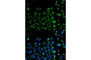 Image no. 2 for anti-Autophagy Related 13 (ATG13) antibody (ABIN3021088)