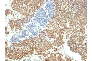 Image no. 4 for anti-BMI1 Polycomb Ring Finger Oncogene (BMI1) (AA 142-326) antibody (ABIN6940581)