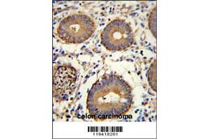 Image no. 2 for anti-Carcinoembryonic Antigen Gene Family (CEA) (AA 400-429) antibody (ABIN390407)
