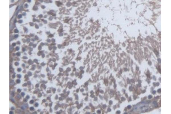 SKAP1 antibody  (AA 1-354)