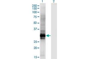 Western Blot analysis of HOXB6 expression in transfected 293T cell line by HOXB6 monoclonal antibody (M01), clone 8E3.