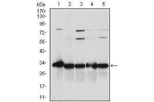 Image no. 3 for anti-NAD(P)H Dehydrogenase, Quinone 1 (NQO1) antibody (ABIN969319)