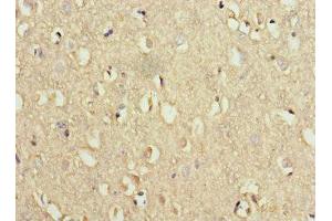Immunohistochemistry of paraffin-embedded human brain tissue using ABIN7175774 at dilution of 1:100