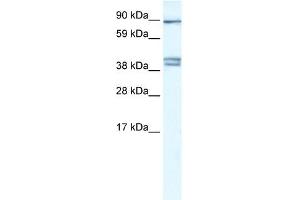 Image no. 1 for anti-Chloride Channel Kb (CLCNKB) (C-Term) antibody (ABIN2776083)