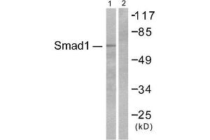 Image no. 2 for anti-SMAD, Mothers Against DPP Homolog 1 (SMAD1) (Ser465) antibody (ABIN1847896)
