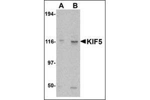 Image no. 2 for anti-Kinesin Family Member 5A (KIF5A) (C-Term) antibody (ABIN500118)