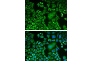 Image no. 1 for anti-ARP3 Actin-Related Protein 3 (ACTR3) antibody (ABIN3021339)