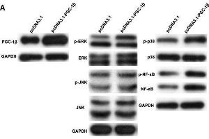 Image no. 3 for anti-Peroxisome Proliferator-Activated Receptor Gamma, Coactivator 1 beta (PPARGC1B) (AA 901-1023) antibody (ABIN872354)