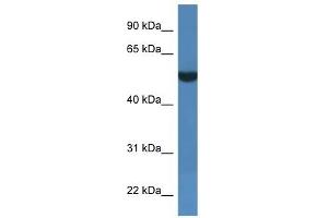 Image no. 1 for anti-Fibronectin Type III and SPRY Domain Containing 1-Like (FSD1L) (C-Term) antibody (ABIN926537)