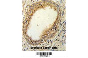 Image no. 2 for anti-Hyaluronan and Proteoglycan Link Protein 1 (HAPLN1) (AA 10-38), (N-Term) antibody (ABIN653748)