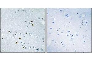 Image no. 1 for anti-Breast Cancer 2, Early Onset (BRCA2) (AA 31-80) antibody (ABIN1533759)