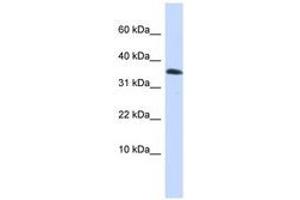 Image no. 1 for anti-Empty Spiracles Homeobox 1 (EMX1) (AA 180-229) antibody (ABIN6741002)