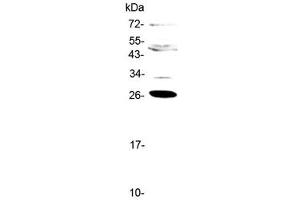 Image no. 2 for anti-Complement Factor D (CFD) (AA 26-253) antibody (ABIN5708189)