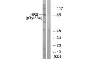 Western blot analysis of extracts from HepG2 cells treated with PMA 125ng/ml 30', using HRS (Phospho-Tyr334) Antibody.